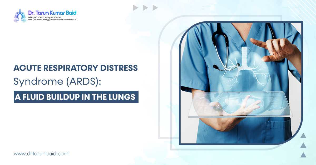 Acute Respiratory Distress Syndrome (ARDS): A Fluid Buildup In The Lungs