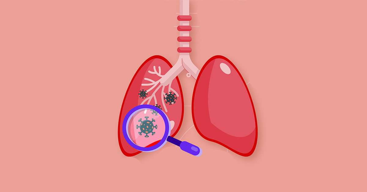 Chronic obstructive pulmonary disease