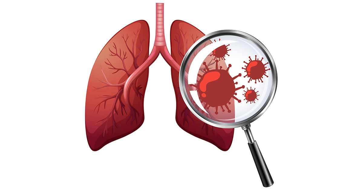 Chronic obstructive pulmonary disease