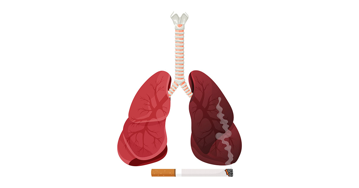 Adverse Impact of Smoking on Your Respiratory System